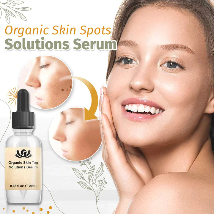 Spot-free™ - Bio-Lösung für Hautflecken Serum