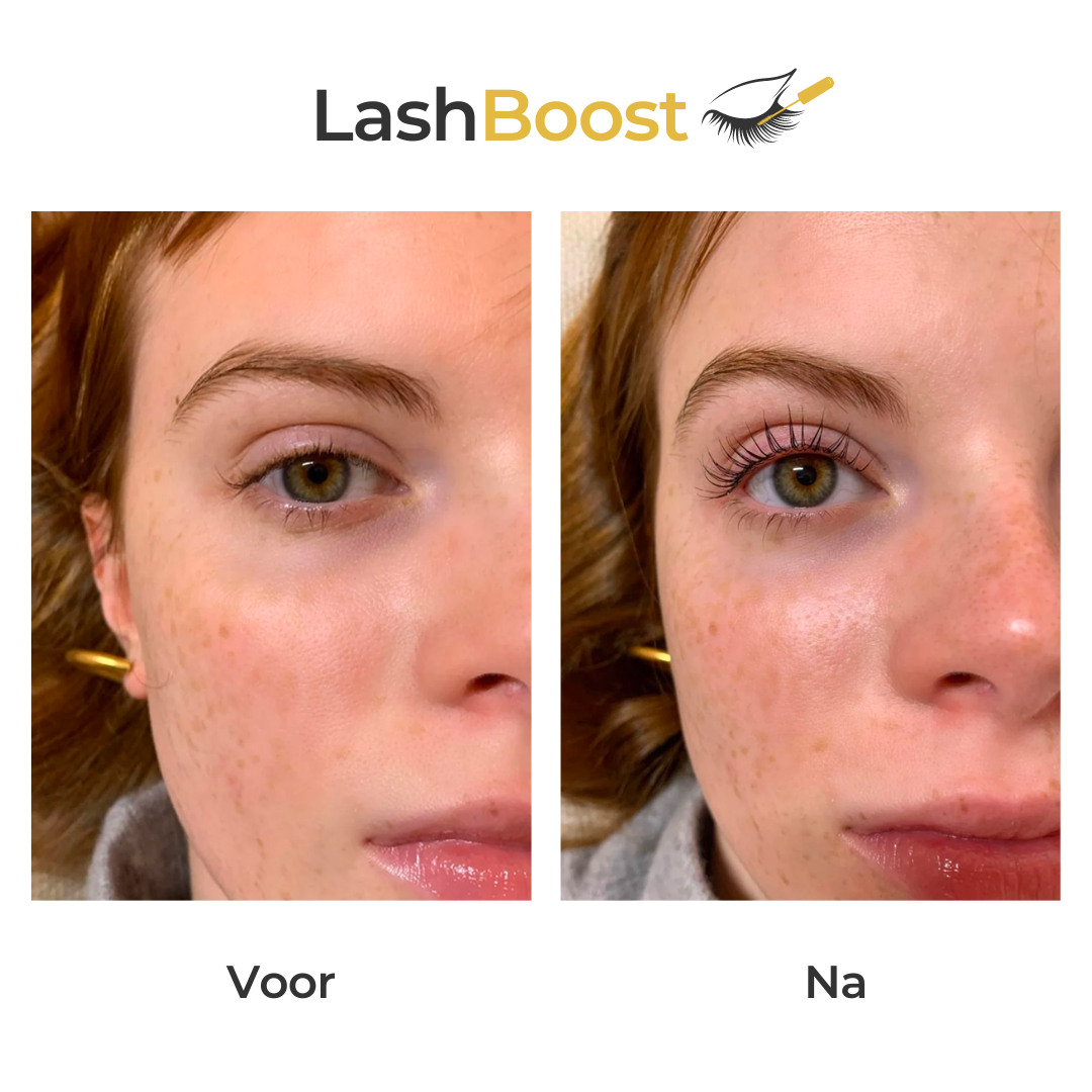 Lash Booster ™ | Wimpernwachstumsserum | 50% Rabatt Begrenztes Angebot